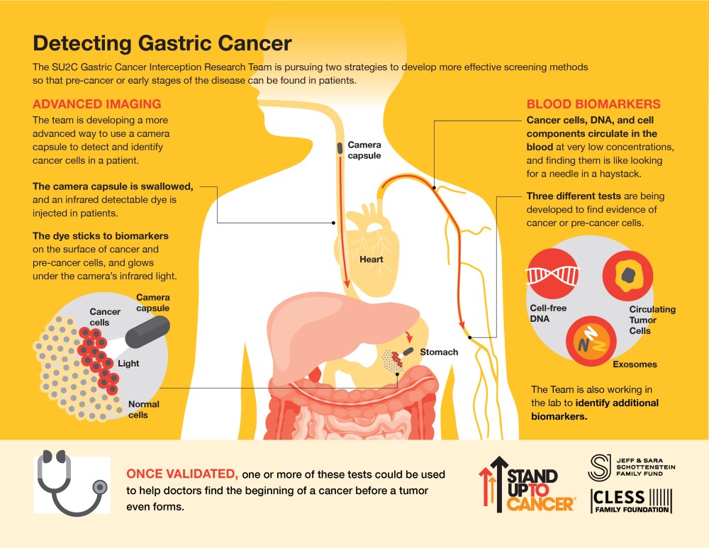 gastric cancer thesis