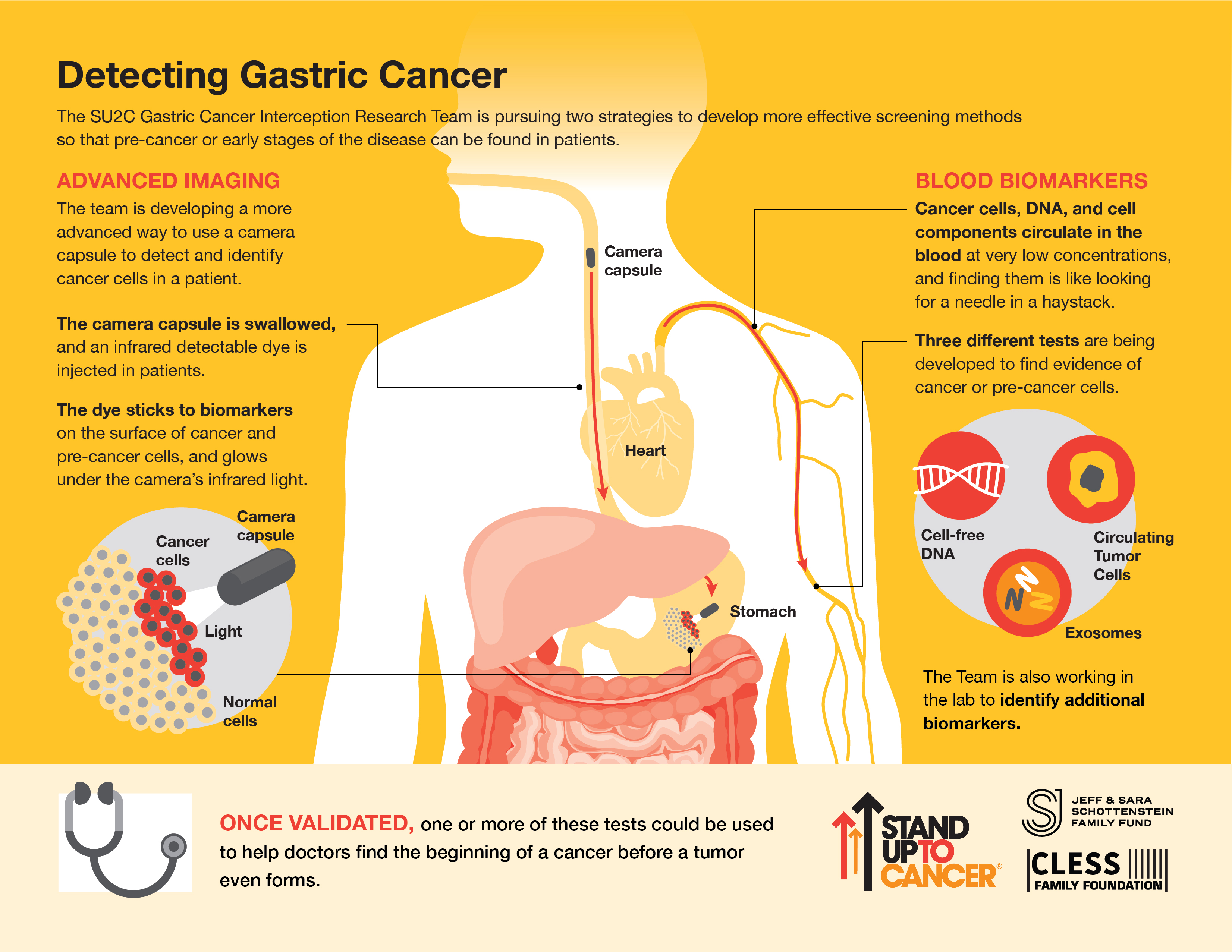 Detecting Gastric Cancer